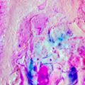 Badanie histologiczne – czym jest i kiedy jest wykonywane?