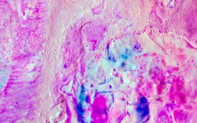 Badanie histologiczne – czym jest i kiedy jest wykonywane?