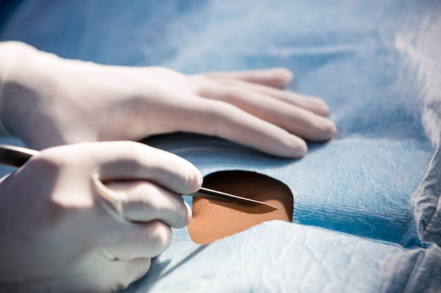 Ile trwa operacja prostaty i od czego to zależy?